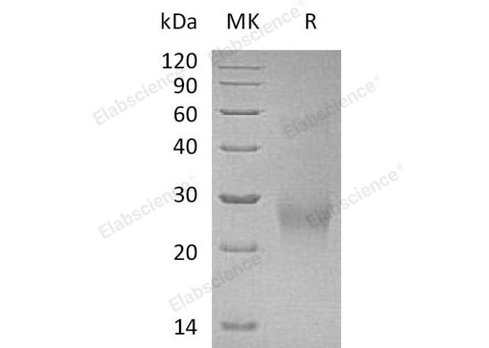 Recombinant Human CDK2AP2 Protein (Human Cells, His Tag) - ABMIUM
