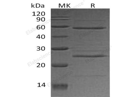 Recombinant Human ODC1 Protein (His & T7 Tag) - ABMIUM