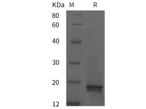 SDS-PAGE analysis of Human IL-18 proteins, 2 μg/lane of Recombinant Human IL-18 proteins was resolved with SDS-PAGE under reducing conditions, showing bands at 18 kDa.