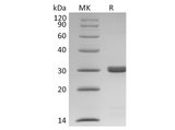 Recombinant Human BCL2L1/Bcl-XL Protein (His Tag) - ABMIUM