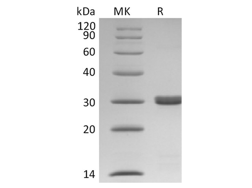 Recombinant Human BCL2L1/Bcl-XL Protein (His Tag) - ABMIUM