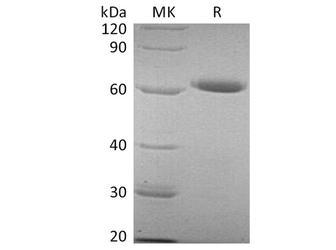Recombinant Human CD73/NT5E Protein (His Tag) - ABMIUM
