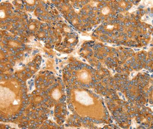 Anti-Human/Mouse/Rat SCT Antibody