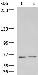 Western blot analysis of Mouse brain tissue and Human cerebrum tissue lysates using EXD2 Polyclonal Antibody at dilution of 1:700