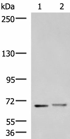 Western blot analysis of Mouse brain tissue and Human cerebrum tissue lysates using EXD2 Polyclonal Antibody at dilution of 1:700