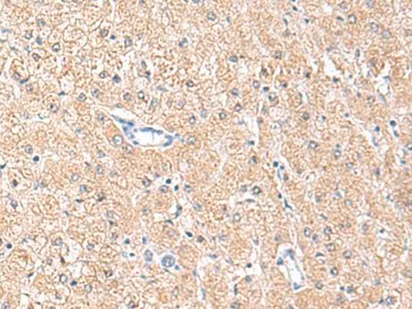 Anti-Human MLKL Antibody