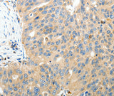 Anti-Human/Mouse/Rat RAMP3 Antibody - ABMIUM