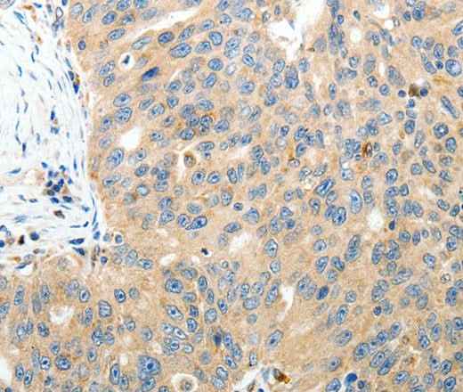 Anti-Human/Mouse/Rat RAMP3 Antibody