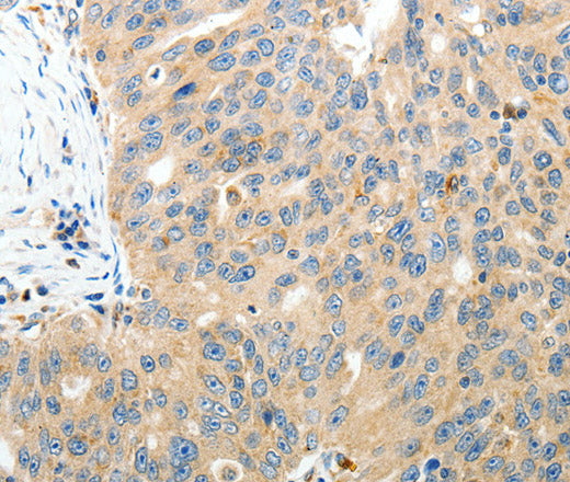 Anti-Human/Mouse/Rat RAMP3 Antibody - ABMIUM