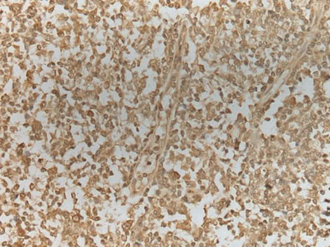 Immunohistochemistry of paraffin-embedded Human tonsil tissue using ZNF8 Polyclonal Antibody at dilution of 1:40(×200)