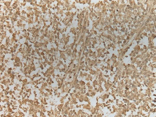 Immunohistochemistry of paraffin-embedded Human tonsil tissue using ZNF8 Polyclonal Antibody at dilution of 1:40(×200)