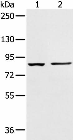 Western blot analysis of 293T cell and Human left kidney tissue using AAK1 Polyclonal Antibody at dilution of 1:400