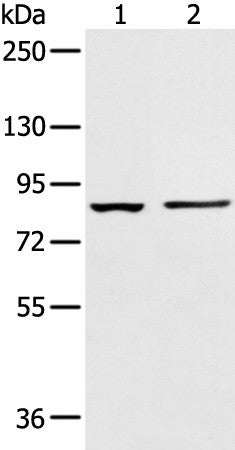Western blot analysis of 293T cell and Human left kidney tissue using AAK1 Polyclonal Antibody at dilution of 1:400