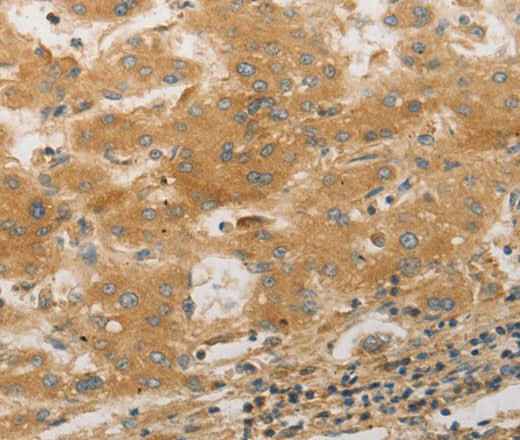 Anti-Human/Mouse/Rat PPAP2A Antibody