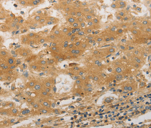 Anti-Human/Mouse/Rat PPAP2A Antibody - ABMIUM