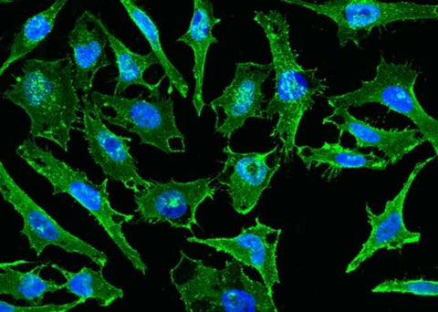 Anti-Human CD44 Antibody - ABMIUM