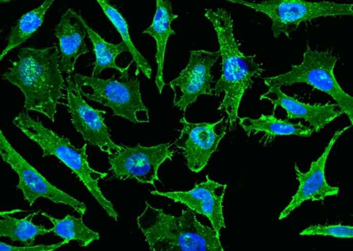 Anti-Human CD44 Antibody - ABMIUM