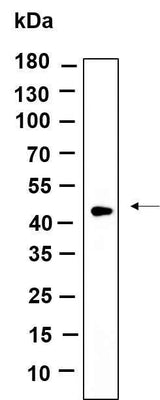Anti-Human/Mouse/Rat TPST2 Antibody [B985]