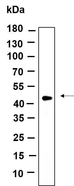 Anti-Human/Mouse/Rat TPST2 Antibody [B985]