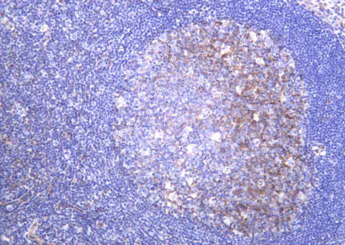 Anti-Human/Mouse/Rat Integrin α5 Antibody [B1021] - ABMIUM
