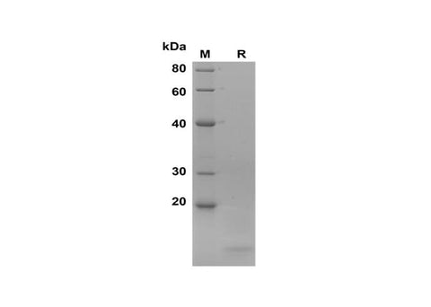SDS-PAGE analysis of Green monkey Calcitonin/CT proteins, 2 μg/lane of Recombinant Green monkey Calcitonin/CT proteins was resolved with SDS-PAGE under reducing conditions, showing bands at 15 kDa.
