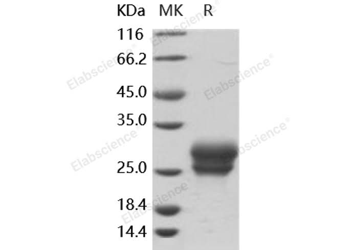 Recombinant Human Frizzled-4/FZD4 Protein (His Tag) - ABMIUM
