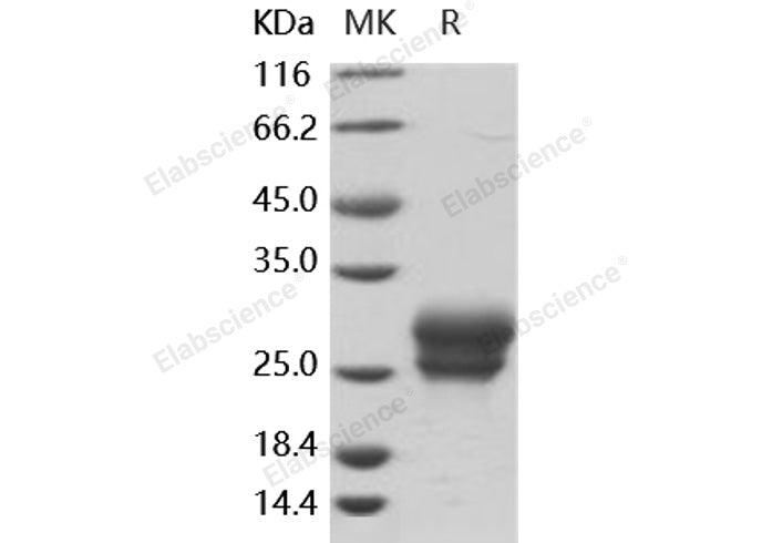 Recombinant Human Frizzled-4/FZD4 Protein (His Tag) - ABMIUM