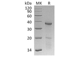 Recombinant Human HOXB4 Protein (His Tag) - ABMIUM