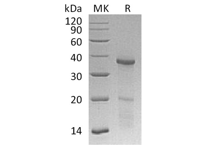 Recombinant Human HOXB4 Protein (His Tag) - ABMIUM