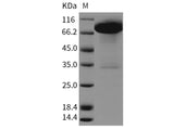 Recombinant Rat DDR1 Kinase/CD167 Protein (Fc Tag) - ABMIUM