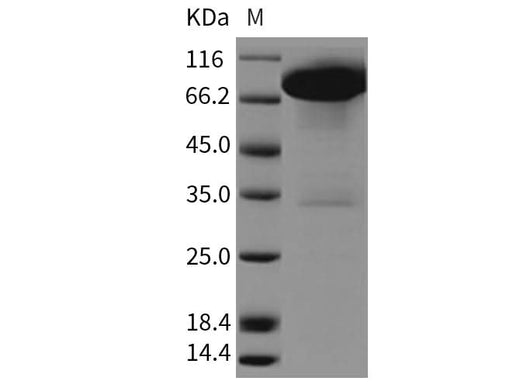 Recombinant Rat DDR1 Kinase/CD167 Protein (Fc Tag) - ABMIUM