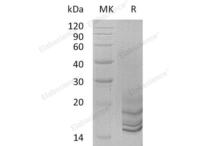 Recombinant Human Progonadoliberin-2/GNRH2 Protein (His Tag) - ABMIUM