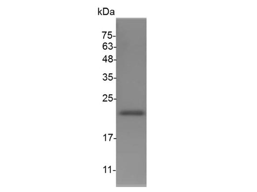 Recombinant Mouse G-CSF protein(N-His) - ABMIUM