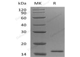 Recombinant Human EIF1B Protein (His Tag) - ABMIUM