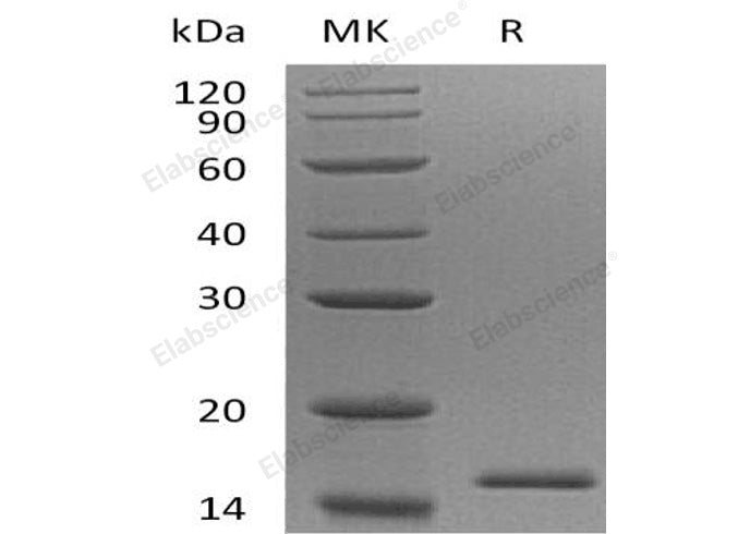 Recombinant Human EIF1B Protein (His Tag) - ABMIUM