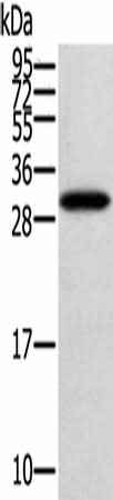 Anti-Human/Mouse STARD5 Antibody