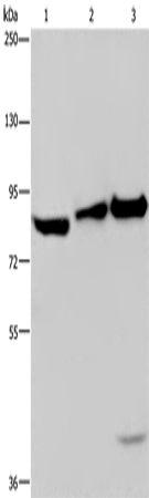 Anti-Human/Mouse ECE1 Antibody - ABMIUM