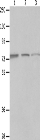 Anti-Human/Mouse/Rat MAGED1 Antibody - ABMIUM