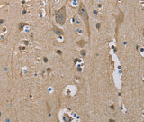 Anti-Human SERPINA1 Antibody - ABMIUM