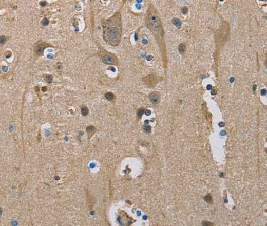 Anti-Human SERPINA1 Antibody