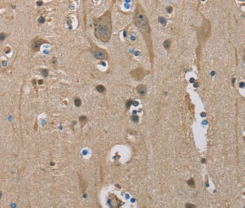 Anti-Human SERPINA1 Antibody - ABMIUM