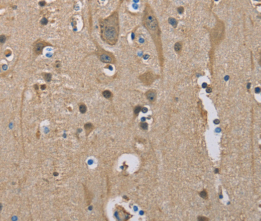 Anti-Human SERPINA1 Antibody - ABMIUM