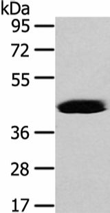 Anti-Human/Mouse VASH2 Antibody - ABMIUM