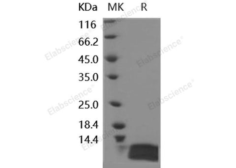 Recombinant Human IL-8/CXCL8 Protein (E.coli) - ABMIUM