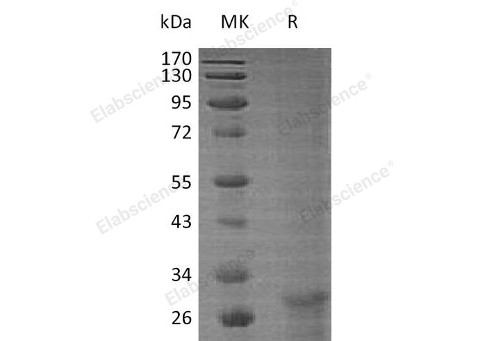 Recombinant Human KLF6 Protein - ABMIUM