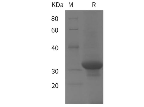 SDS-PAGE analysis of Human UCP1 proteins, 2 μg/lane of Recombinant Human UCP1 proteins was resolved with SDS-PAGE under reducing conditions, showing bands at 31 kDa.