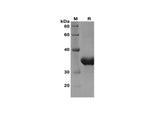 SDS-PAGE analysis of Human RNF25 proteins, 2 μg/lane of Recombinant Human RNF25 proteins was resolved with SDS-PAGE under reducing conditions, showing bands at 35 kDa.