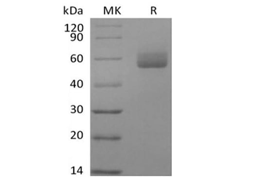 Recombinant Human GPIHBP1 (C-Fc) - ABMIUM