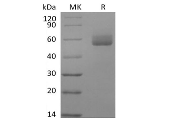 Recombinant Human GPIHBP1 (C-Fc) - ABMIUM