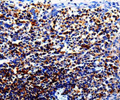 Anti-Human IL10RA Antibody